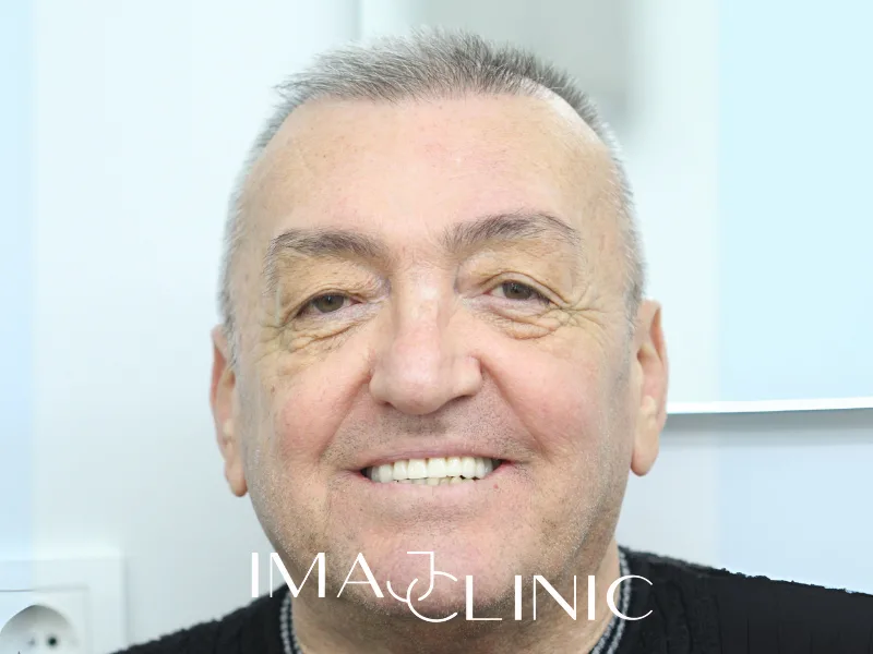 Tedavi sonrası vaka 17