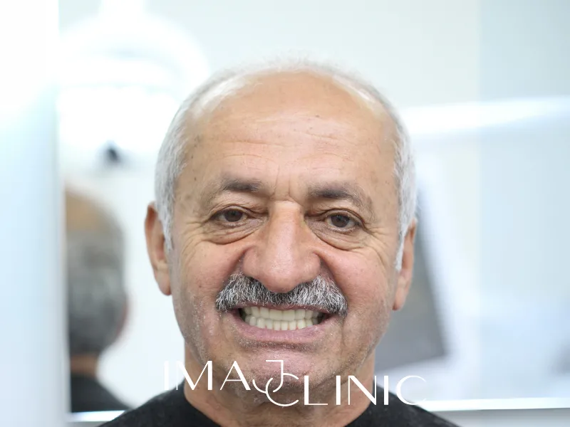Tedavi sonrası vaka 10