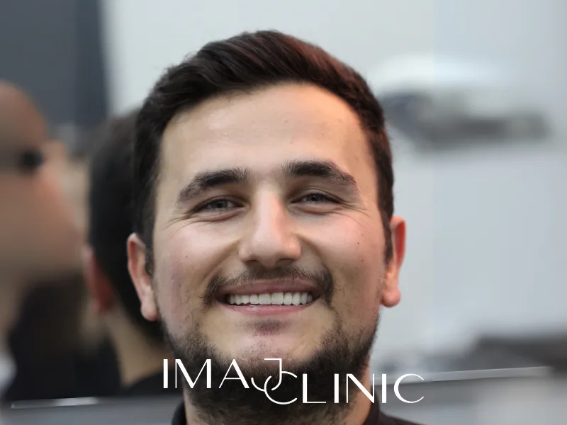 Tedavi sonrası vaka 5